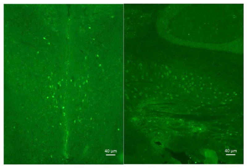 Selective Neuronal and Brain Regional Expession of IL-2 in IL2P 8-GFP Transgenic Mice: Relation to Sensorimotor Gating.