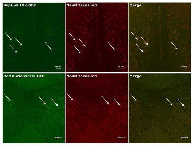 Selective Neuronal and Brain Regional Expession of IL-2 in IL2P 8-GFP Transgenic Mice: Relation to Sensorimotor Gating.