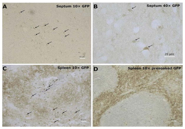 Selective Neuronal and Brain Regional Expession of IL-2 in IL2P 8-GFP Transgenic Mice: Relation to Sensorimotor Gating.