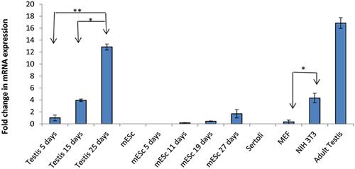 Analysis of SPATA19 gene expression during male germ cells development, lessons from in vivo and in vitro study