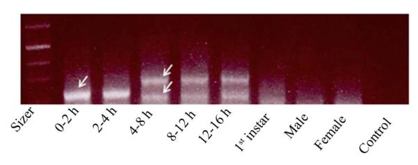 A molecular, phylogenetic and functional study of the <i>dADAR</i> mRNA truncated isoform during <i>Drosophila</i> embryonic development reveals an editing-independent function.