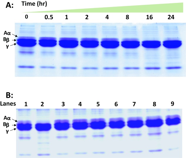 Biochemical and biological characterization of Naja kaouthia venom from North-East India and its neutralization by polyvalent antivenom.