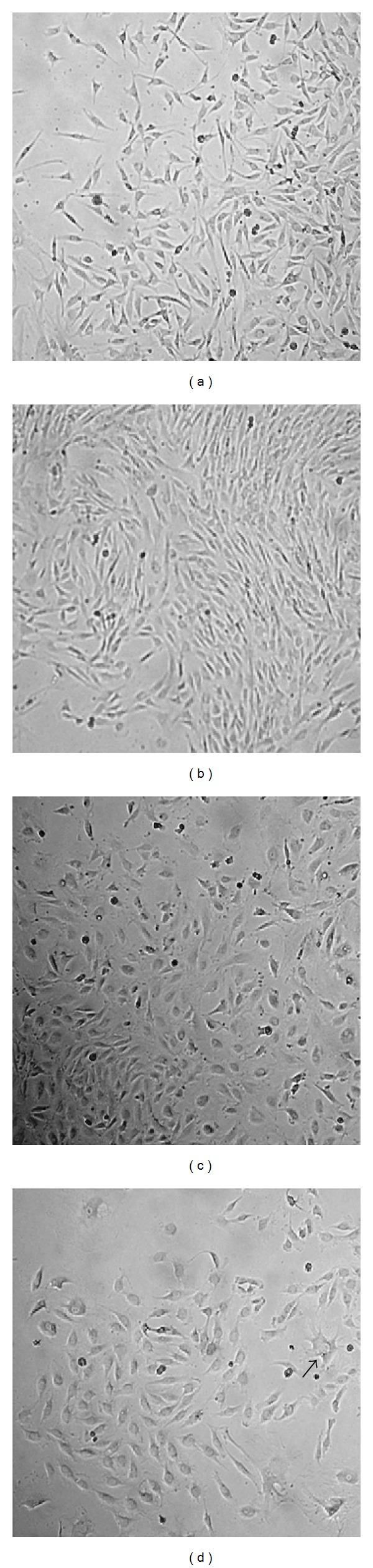 Chromosome aberrations in cells infected with bovine papillomavirus: comparing cutaneous papilloma, esophagus papilloma, and urinary bladder lesion cells.
