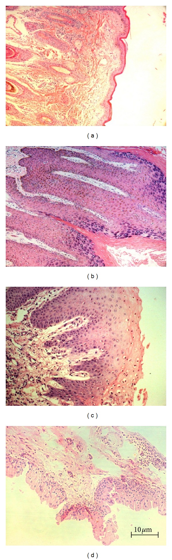 Chromosome aberrations in cells infected with bovine papillomavirus: comparing cutaneous papilloma, esophagus papilloma, and urinary bladder lesion cells.