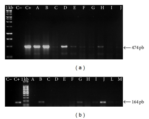 Chromosome aberrations in cells infected with bovine papillomavirus: comparing cutaneous papilloma, esophagus papilloma, and urinary bladder lesion cells.