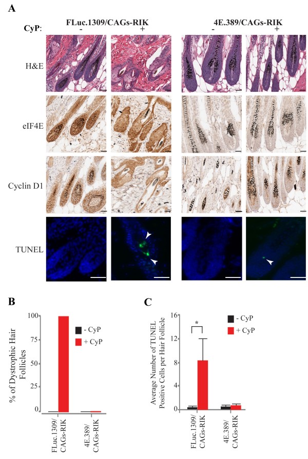 Suppression of eukaryotic initiation factor 4E prevents chemotherapy-induced alopecia.