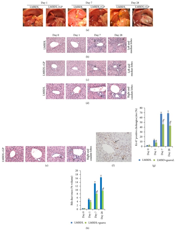 Protective Effects of Guava Pulp on Cholestatic Liver Injury.