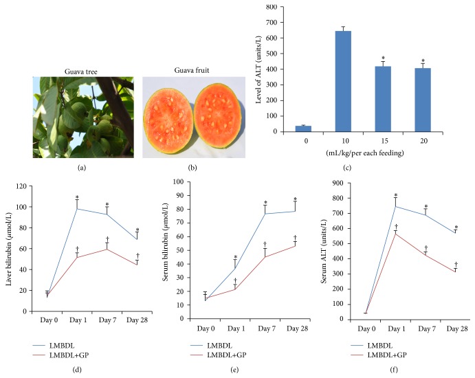 Protective Effects of Guava Pulp on Cholestatic Liver Injury.