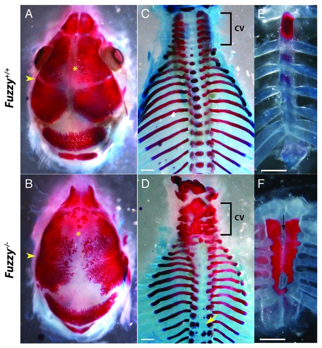 Common skeletal features in rare diseases: New links between ciliopathies and FGF-related syndromes.