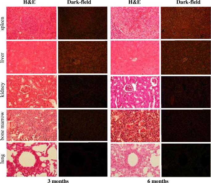 In vivo uptake and cellular distribution of gold nanoshells in a preclinical model of xenografted human renal cancer