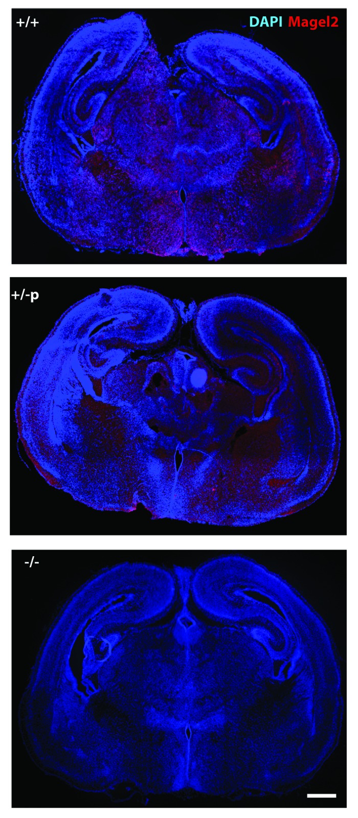 Natural breaking of the maternal silence at the mouse and human imprinted Prader-Willi locus: A whisper with functional consequences.