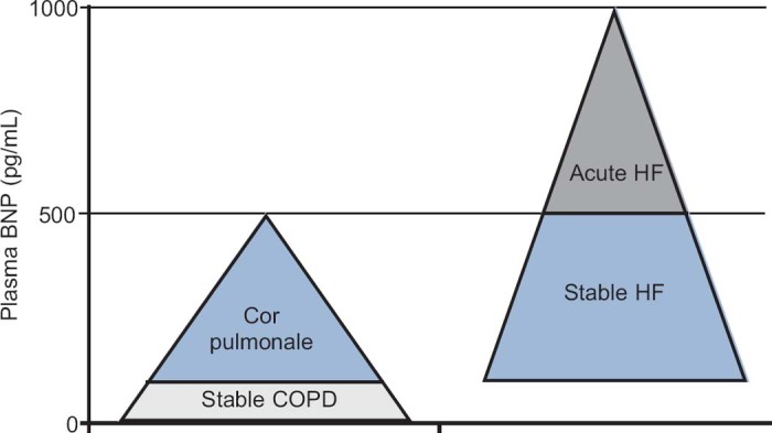 A woman with breathlessness: a practical approach to diagnosis and management.