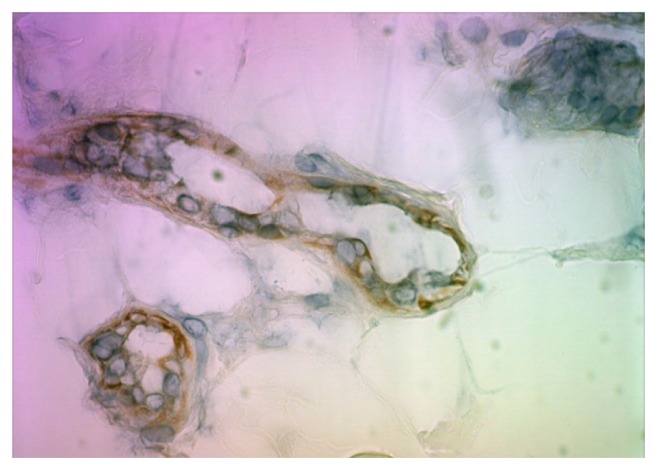 Immunohistochemical studies of the kynurenine pathway in morphea.