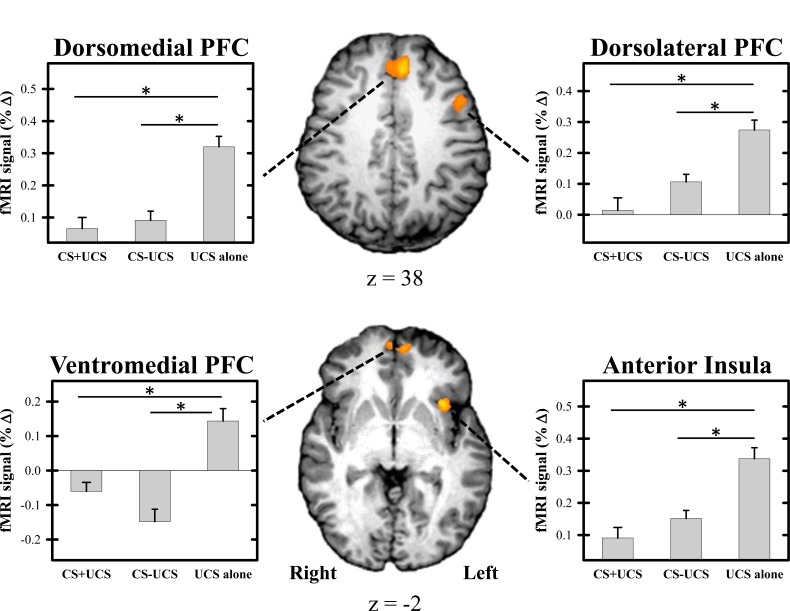 Neural substrates underlying learning-related changes of the unconditioned fear response.