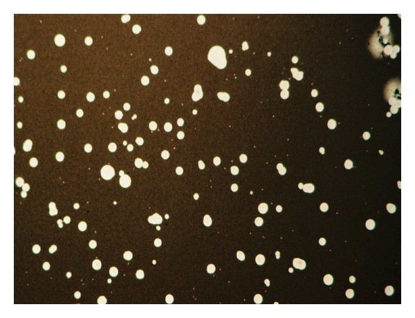 New Insights into HIV/AIDS-Associated Cryptococcosis.