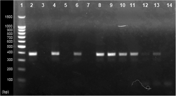 Circulating rotaviral RNA in children with rotavirus antigenemia.