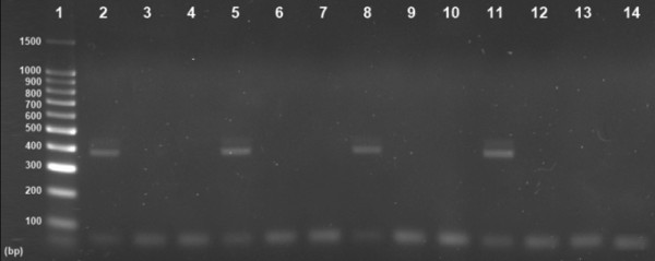 Circulating rotaviral RNA in children with rotavirus antigenemia.