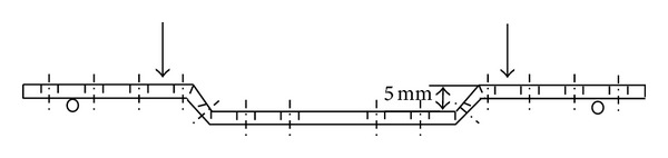 Comparing the In Vitro Stiffness of Straight-DCP, Wave-DCP, and LCP Bone Plates for Femoral Osteosynthesis.