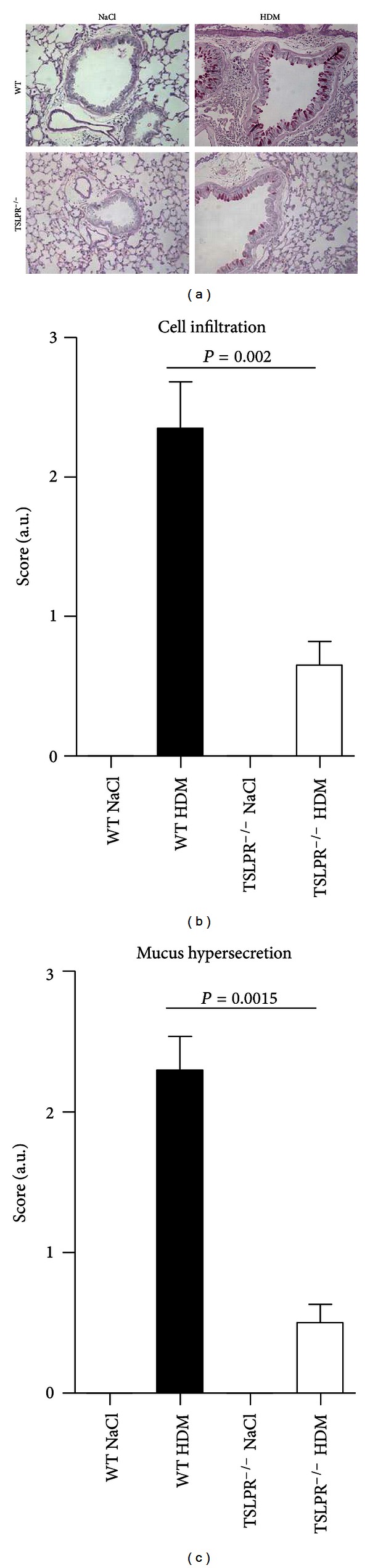 Thymic Stromal Lymphopoietin Enhances Th2/Th22 and Reduces IL-17A in Protease-Allergen-Induced Airways Inflammation.