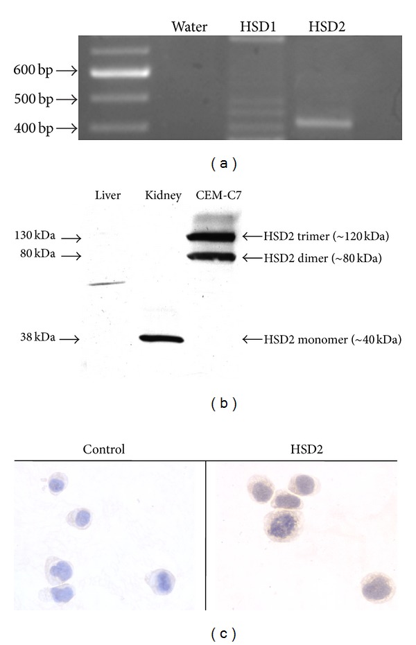 Expression and Regulation of 11- β Hydroxysteroid Dehydrogenase Type 2 Enzyme Activity in the Glucocorticoid-Sensitive CEM-C7 Human Leukemic Cell Line.