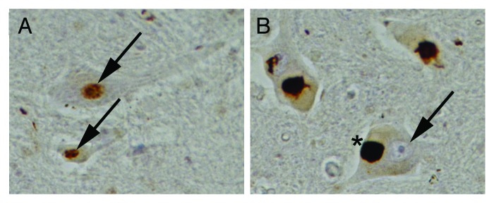 Yeast genetic screen reveals novel therapeutic strategy for ALS.