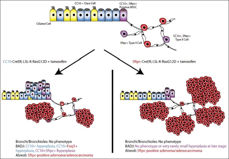 Cell of origin of lung cancer.