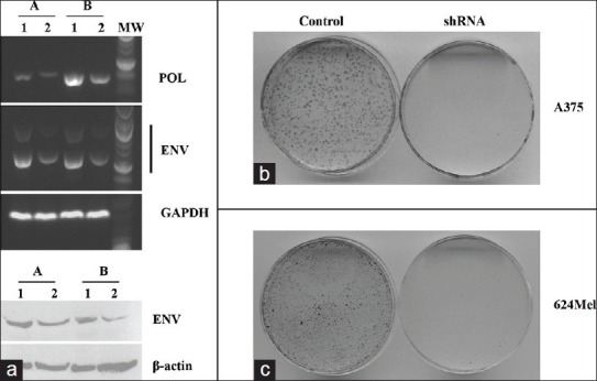 Human endogenous retroviral K element encodes fusogenic activity in melanoma cells.