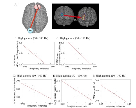 Dysfunctional cortical connectivity during the auditory oddball task in patients with schizophrenia.