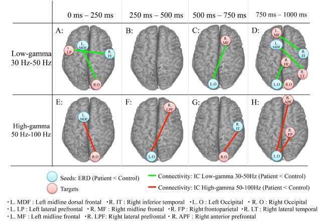 Dysfunctional cortical connectivity during the auditory oddball task in patients with schizophrenia.