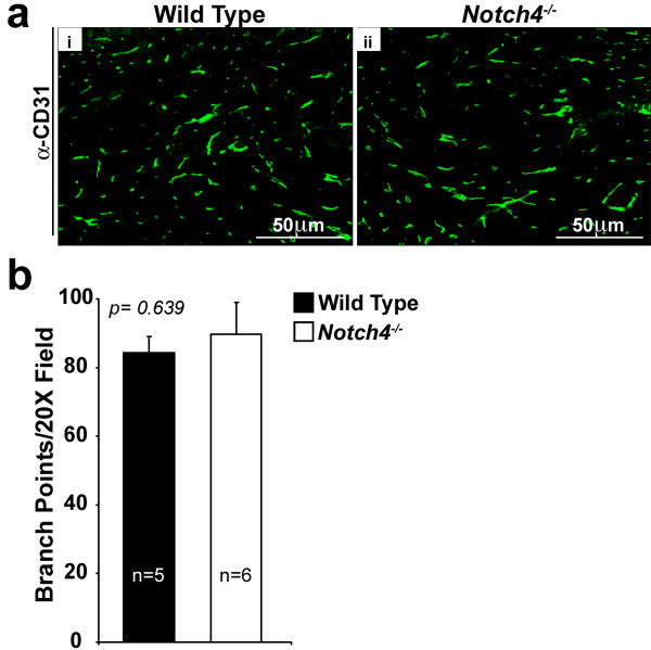 Notch4 is required for tumor onset and perfusion.