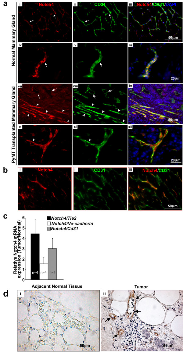 Notch4 is required for tumor onset and perfusion.