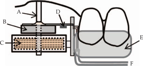 Patient-specific finite element analysis of viscoelastic masticatory mucosa.