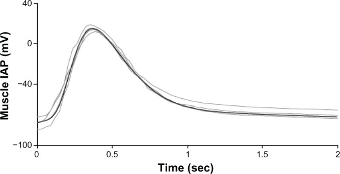 An Empirical Muscle Intracellular Action Potential Model with Multiple Erlang Probability Density Functions based on a Modified Newton Method.