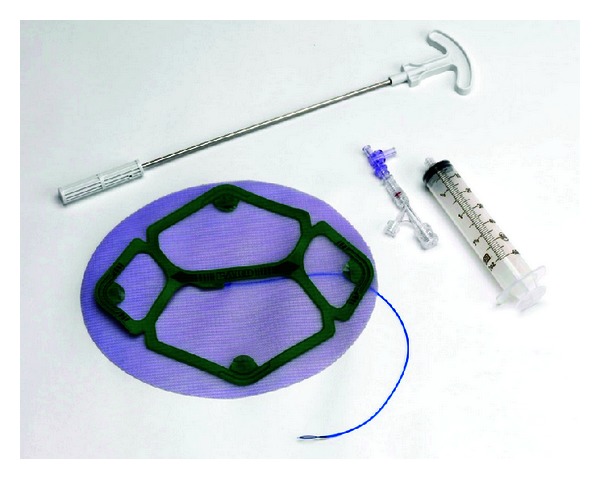 Evaluation of ECHO PS Positioning System in a Porcine Model of Simulated Laparoscopic Ventral Hernia Repair.