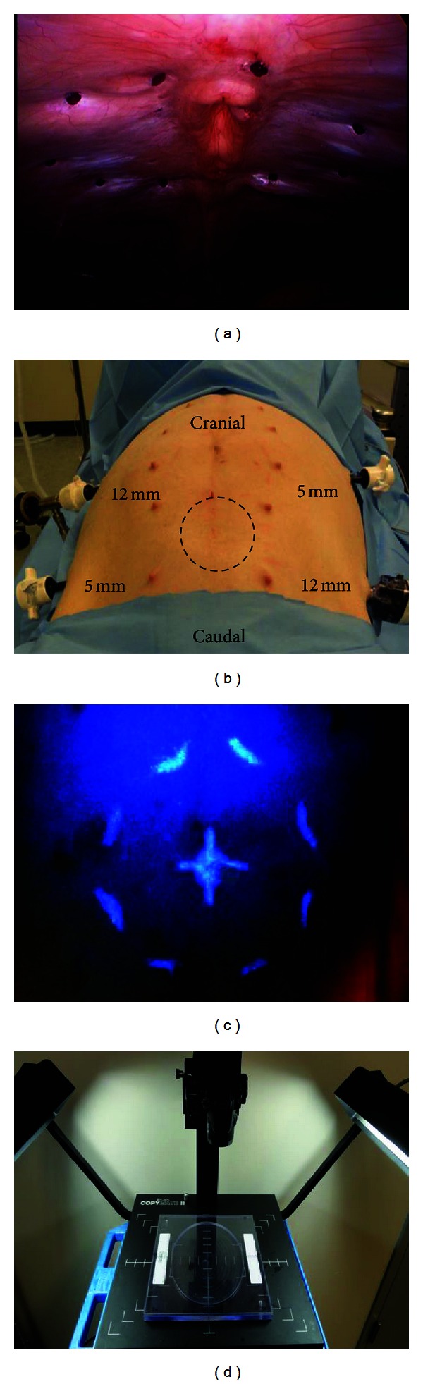 Evaluation of ECHO PS Positioning System in a Porcine Model of Simulated Laparoscopic Ventral Hernia Repair.