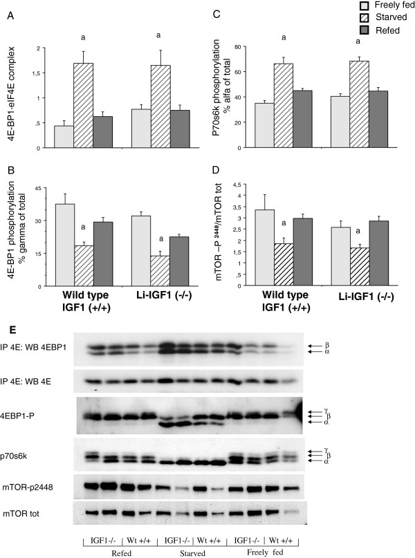 Liver-derived endocrine IGF-I is not critical for activation of skeletal muscle protein synthesis following oral feeding.