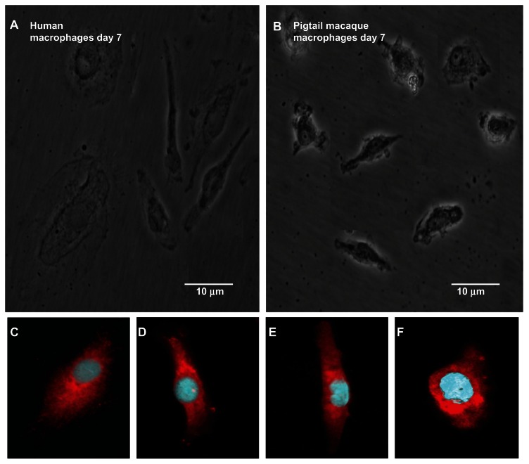 Characterization of the kynurenine pathway and quinolinic Acid production in macaque macrophages.