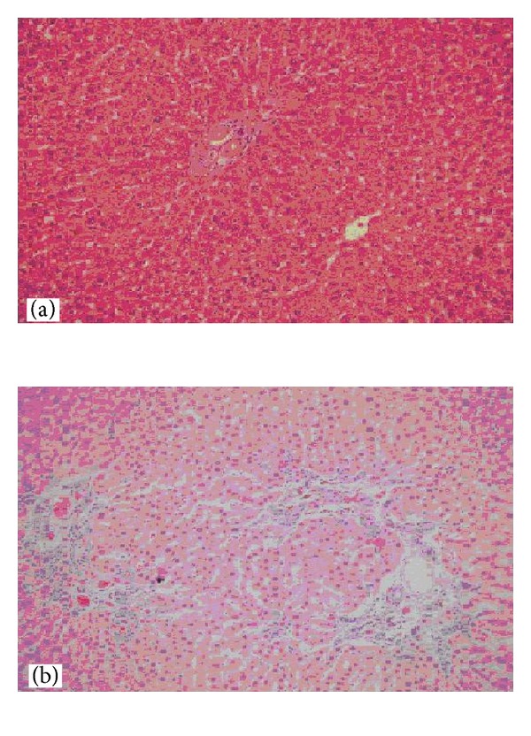 The effects of bile duct obstruction on liver volume: an experimental study.