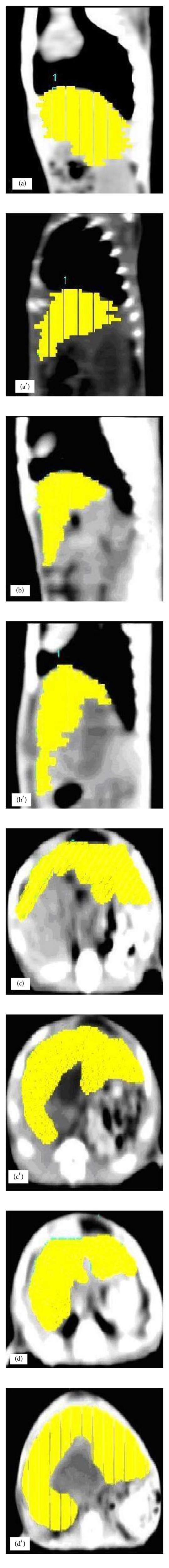 The effects of bile duct obstruction on liver volume: an experimental study.