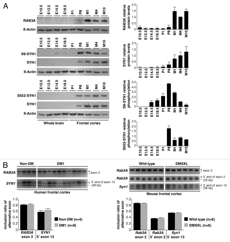 Synaptic protein dysregulation in myotonic dystrophy type 1: Disease neuropathogenesis beyond missplicing.