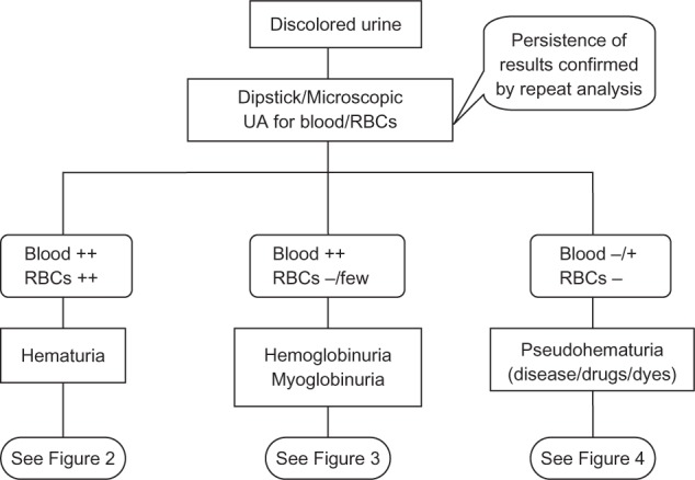 Hemoglobinuria misidentified as hematuria: review of discolored urine and paroxysmal nocturnal hemoglobinuria.