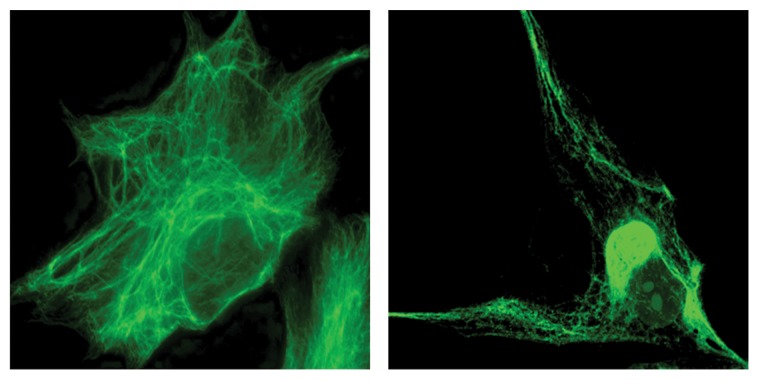 Explaining intermediate filament accumulation in giant axonal neuropathy.