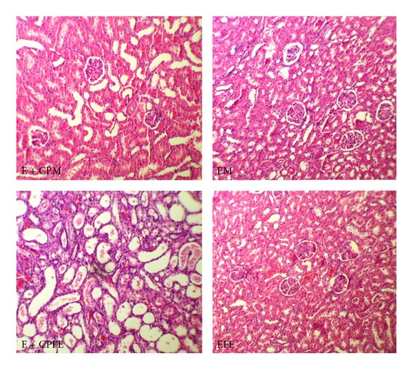 Vitamin e is a nephroprotectant agent in male but not in female in a model of Cisplatin-induced nephrotoxicity.