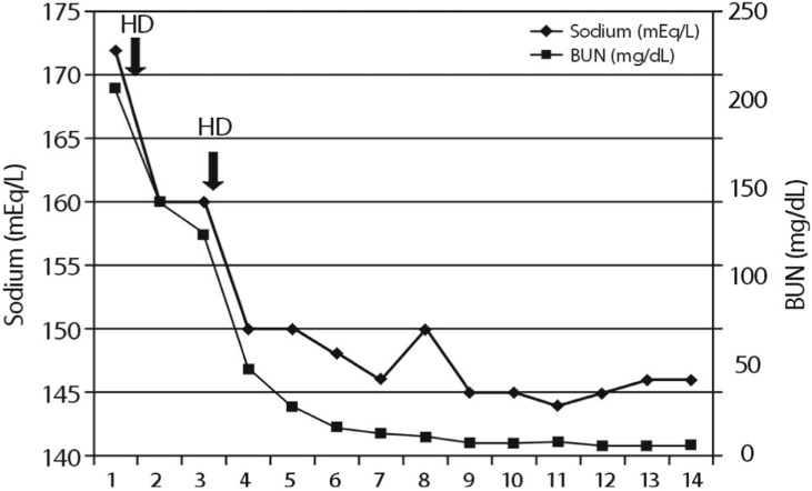 Paranoid Adipsia-induced Severe Hypernatremia and Uremia treated with Hemodialysis.