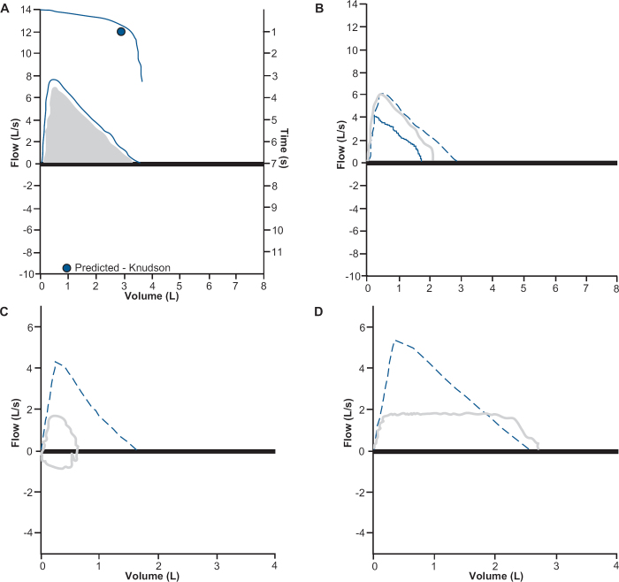 Spirometry in children.