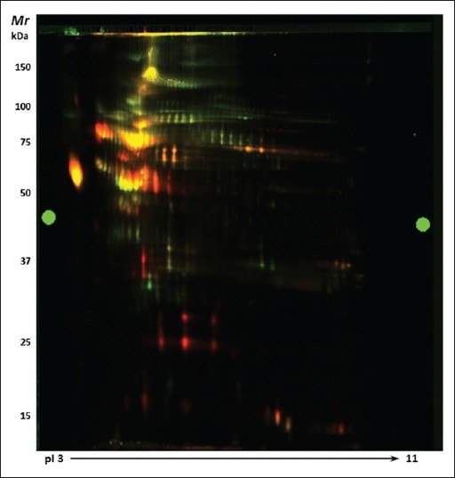 Stage-specific analysis of plasma protein profiles in ovarian cancer: Difference in-gel electrophoresis analysis of pooled clinical samples.