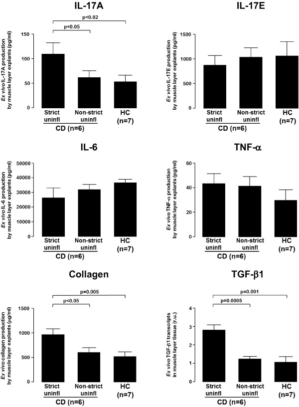 The role of interleukin 17 in Crohn's disease-associated intestinal fibrosis.