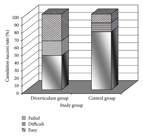 ERCP features and outcome in patients with periampullary duodenal diverticulum.