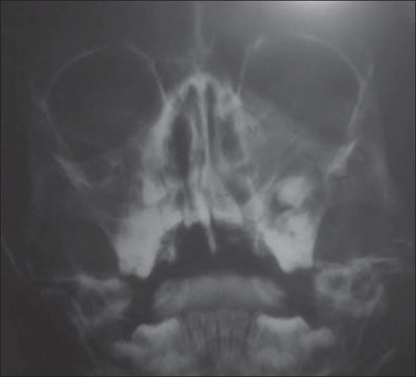 Abstract Image