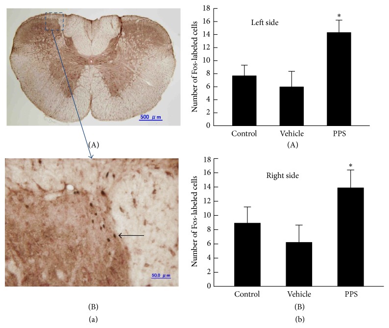 Neural Mechanisms That Underlie Angina-Induced Referred Pain in the Trigeminal Nerve Territory: A c-Fos Study in Rats.